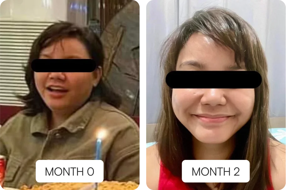 S. Vera - Before vs After